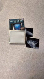 🩻 Kitan Club - Rentogen Light (X-Ray Light Mini Negatoscopio)